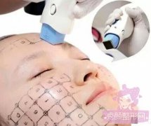 <b>热玛吉，超声提拉，4D埋线提升哪个果好？</b>