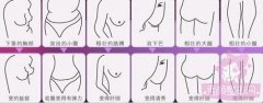 抽脂减肥价格一览表