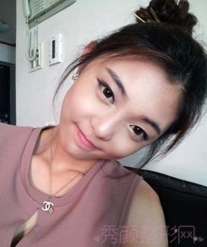 做了隆鼻和磨骨,怎么样,韩国范儿~