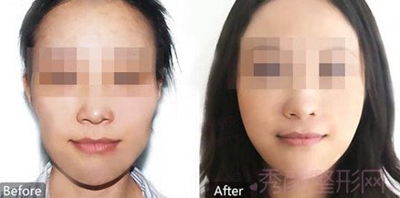 北京整形医生乔爱军、李发成和李朕哪个好?