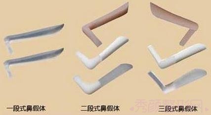 韩式生科隆鼻假体一段、二段、三段有什么区别