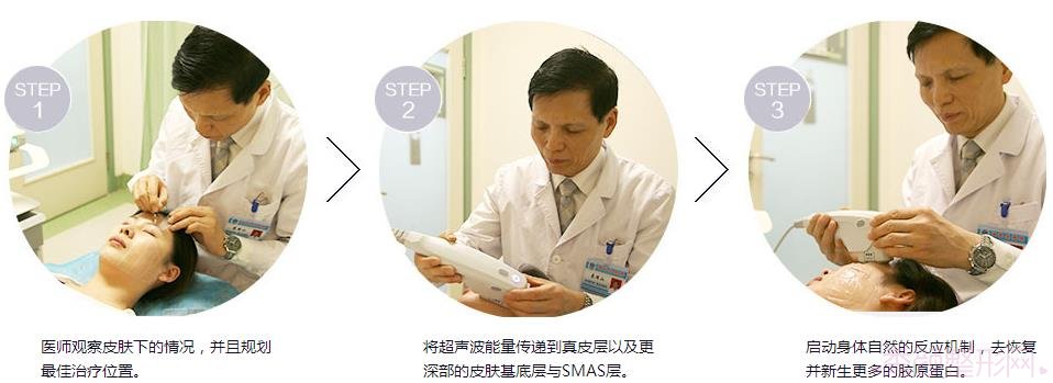 北京哪家医院超声提拉好?多少钱?