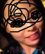 上海九院垫下巴，怎么样？需要修复吗？