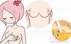 <b>北京取奥美定需要多少钱？取出CG高吗？</b>