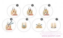 上海华美和百达丽哪个医院隆鼻好？