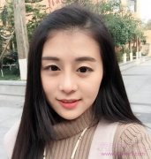 自体脂肪填充额头和太阳穴，美了吗？