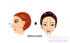 <b>上海华美隆鼻修复哪个医生做的好？</b>
