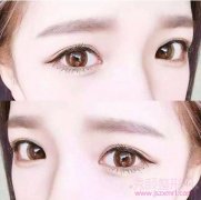 <b>韩式三点和全切有什么区别，哪个好?</b>