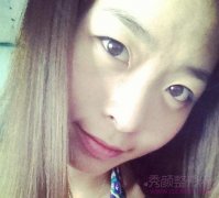 【术后分享】沈阳百嘉丽全切双眼皮未开眼角