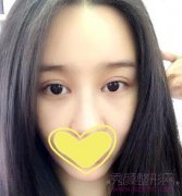 <b>上海华美李健自体脂肪填充怎么样</b>