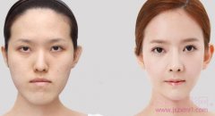 北京八大处整形医院磨颧骨怎么样?哪个医生好