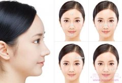 <b>上海九院韦敏整形怎么样?贵吗?</b>