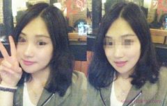 <b>上海华美李志海磨骨怎么样</b>