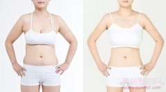 <b>南京华美医院做吸脂手术怎么样?</b>