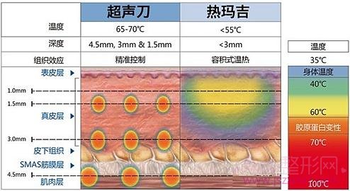 超声提拉和热玛吉能同时一起做吗?