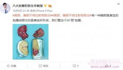 北京八大处辛敏强奥美定取出怎么样?可靠吗?