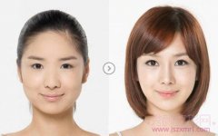 上海九院做假体隆鼻的价格