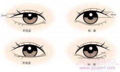 沈阳眼部整形价格表