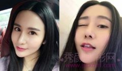 <b>上海百达丽王艳隆鼻怎么样,靠谱吗?</b>