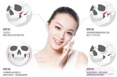 <b>磨骨和削骨有什么区别?哪个风险大?</b>