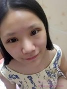 全切双眼皮术后一个月了，持续更~~~~~