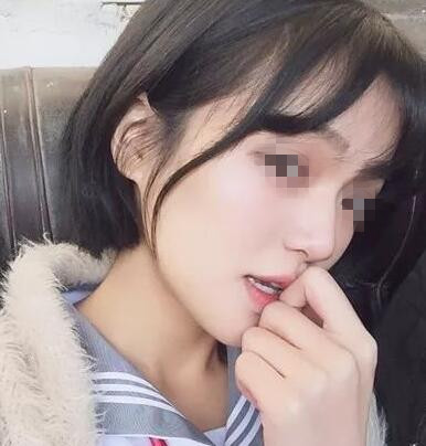 终于摆脱凶相脸,上海磨骨让我蜕变