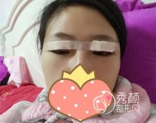 上海百达丽靠谱吗,我割了双眼皮。