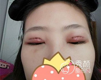 上海百达丽靠谱吗,我割了双眼皮。