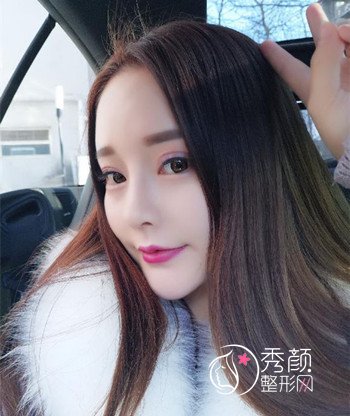 上海艺星做鼻部手术怎么样,我来分享一下。