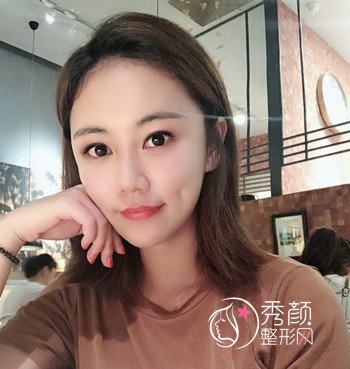 杭州华山连天美高俊明磨骨怎么样,快来看看。