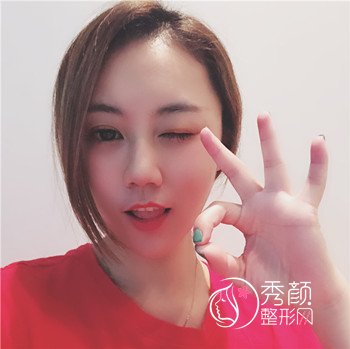 杭州华山连天美高俊明磨骨怎么样,快来看看。