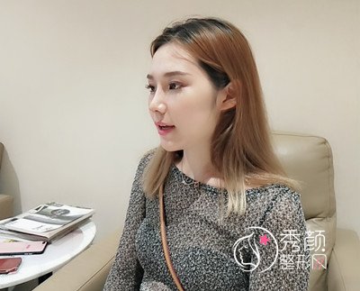 上海薇琳鼻部手术隆鼻案例。