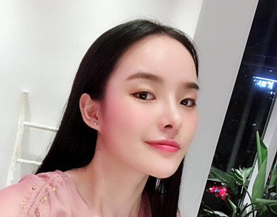 长沙爱思特肋软骨鼻部手术案例。