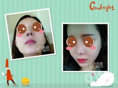 <b>上海华美李志海怎么样,磨骨价格。</b>