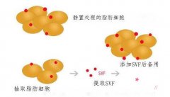 北京京韩SVF活细胞面雕和隆胸价格表