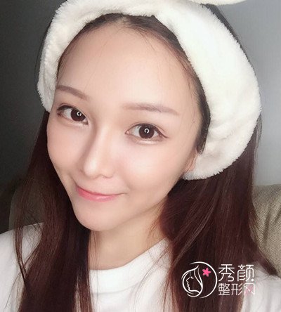 上海薇琳张怀军眼部手术案例。