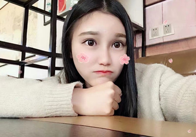 上海华美李志海颧骨内推和削下颌角案例