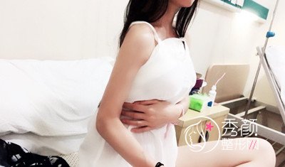 上海华美谢卫国假体隆胸(270cc麦格水滴型)案例