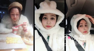 上海九院下颌角整形哪个医生好,徐梁下颌角整形
