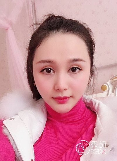 上海九院下颌角整形哪个医生好,徐梁下颌角整形