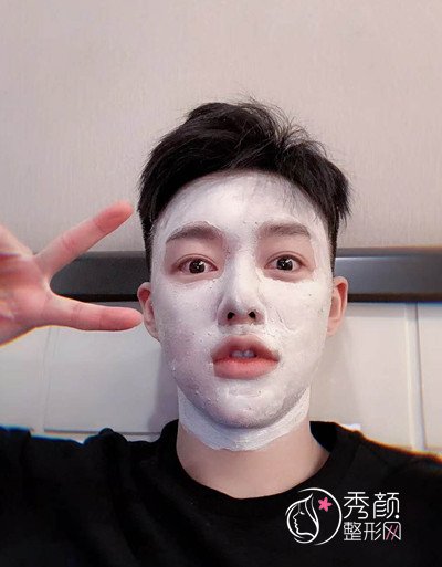 上海男士肋软骨隆鼻案例，恢复好了也是大帅哥一枚！