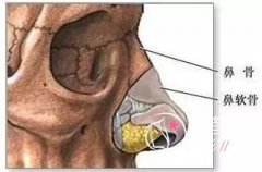 <b>鼻骨内推风险大吗,需要多少钱?有后遗症吗?</b>