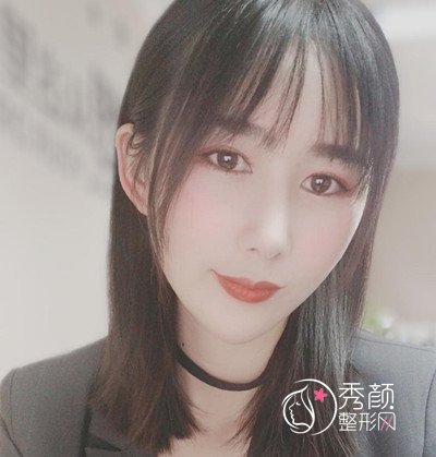 昆明韩辰(肋软骨+膨体)鼻部手术隆鼻案例。