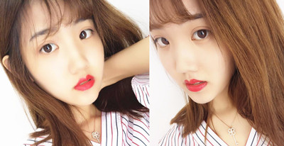 上海薇琳眼部手术做的怎么样,快来看案例分享。