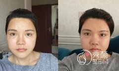 <b>上海天大磨骨怎么样,哪个医生好,案例图。</b>