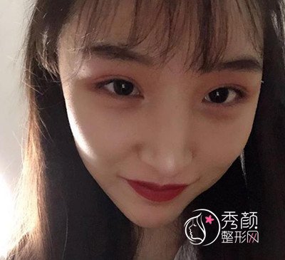 找四川友谊李继华做了磨骨手术,人都变温柔了。