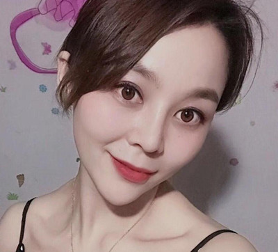 苏州紫馨顾陆健隆鼻怎么样,隆鼻前后对比案例分享。