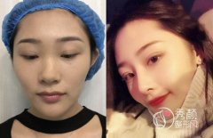 <b>上海容妍李昕隆鼻怎么样,价格案例分享。</b>
