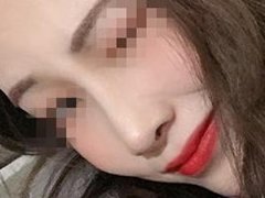 北京谁做鼻子好?北京京民王志坚隆鼻案例分享。