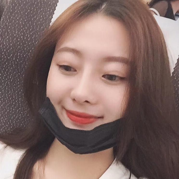 南京华美沈正宇肋软骨隆鼻案例分享。